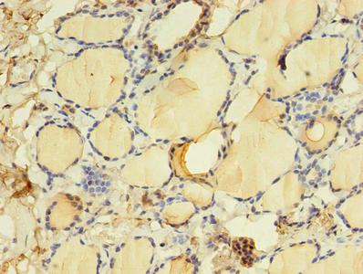 CSB-PA023514LA01HU