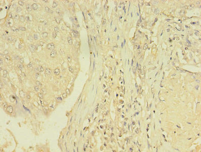 CSB-PA023514LA01HU