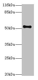 CSB-PA023514LA01HU