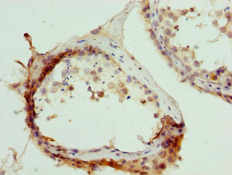 CSB-PA880142LA01HU
