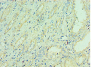CSB-PA015422ESR2HU