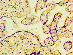 CSB-PA017340ESR2HU