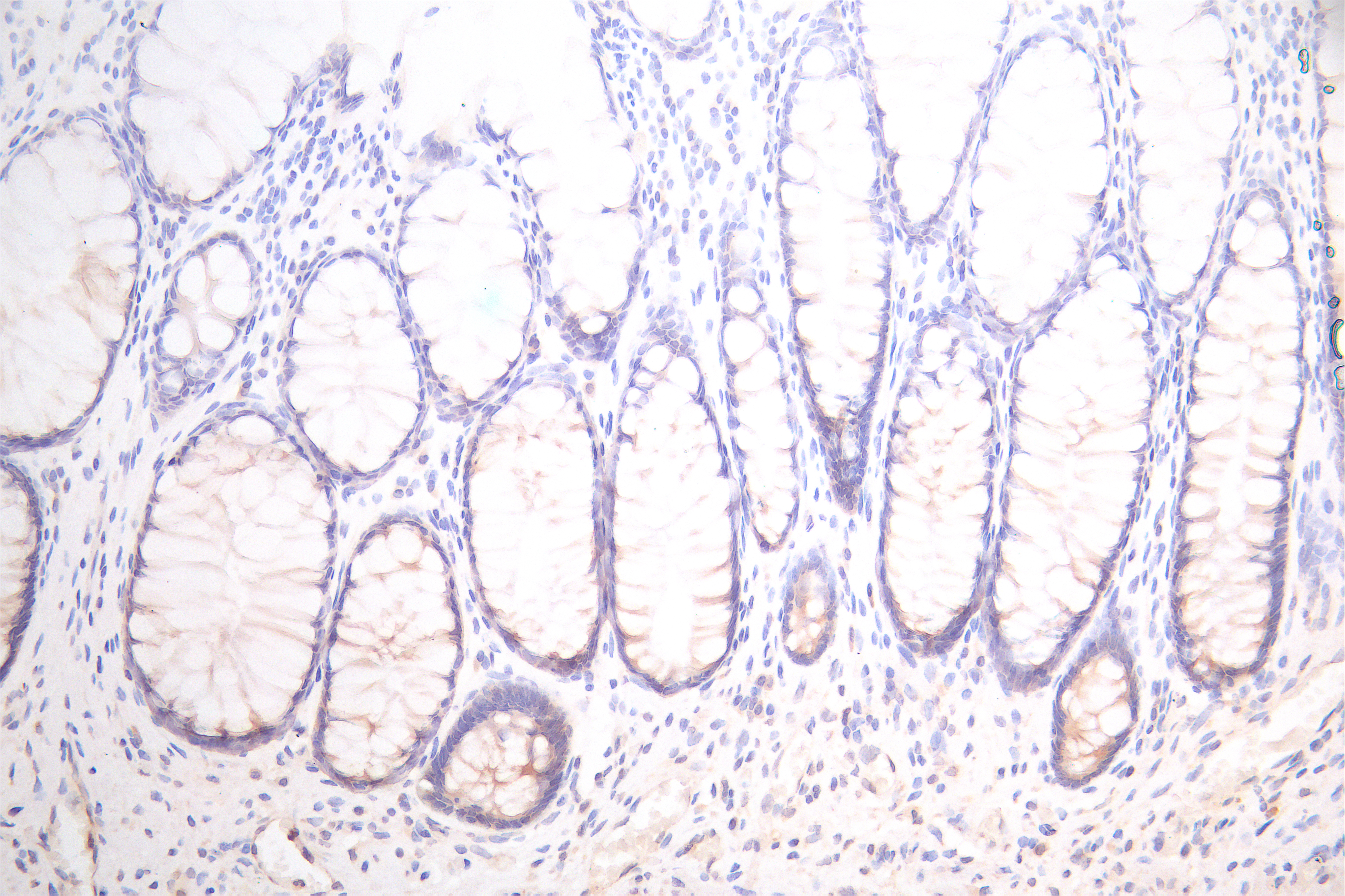 CSB-PA850914ESR2HU