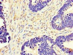CSB-PA015072LA01HU