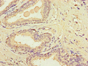 CSB-PA015072LA01HU