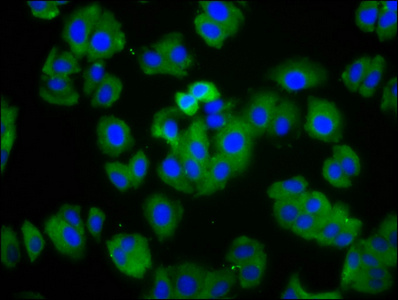 CSB-PA010216LA01HU