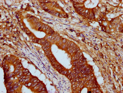 CSB-PA010216LA01HU