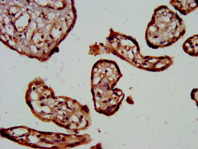 CSB-PA861992LA01HU