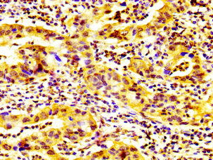 CSB-PA872550LA01HU