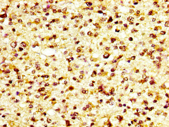 CSB-PA872550LA01HU