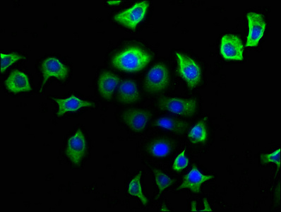 CSB-PA016036LA01HU