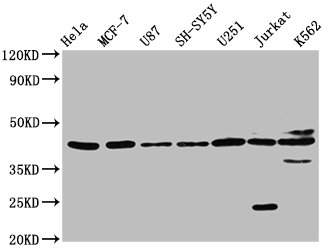 CSB-PA016036LA01HU