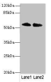 CSB-PA880142LA01HU