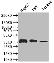 CSB-RA024077MA1HU WB