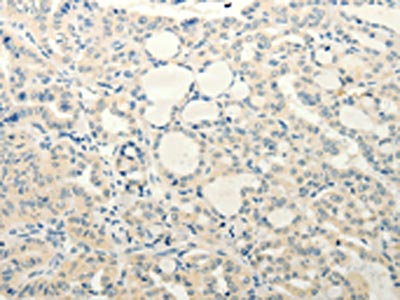 CSB-PA155823