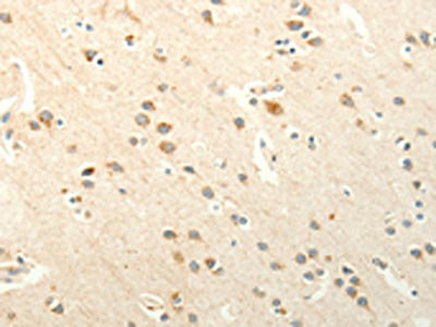 CSB-PA155823